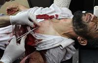  Rabaa protester stitches 